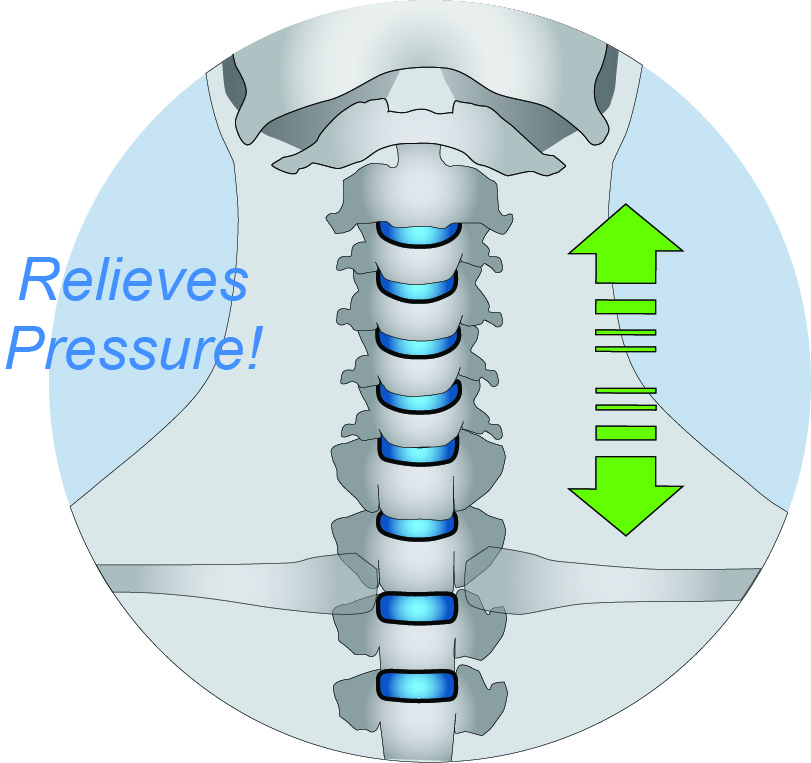CerviPedic Neck-Relief™ opens the intervertebral spaces and relieves pressure