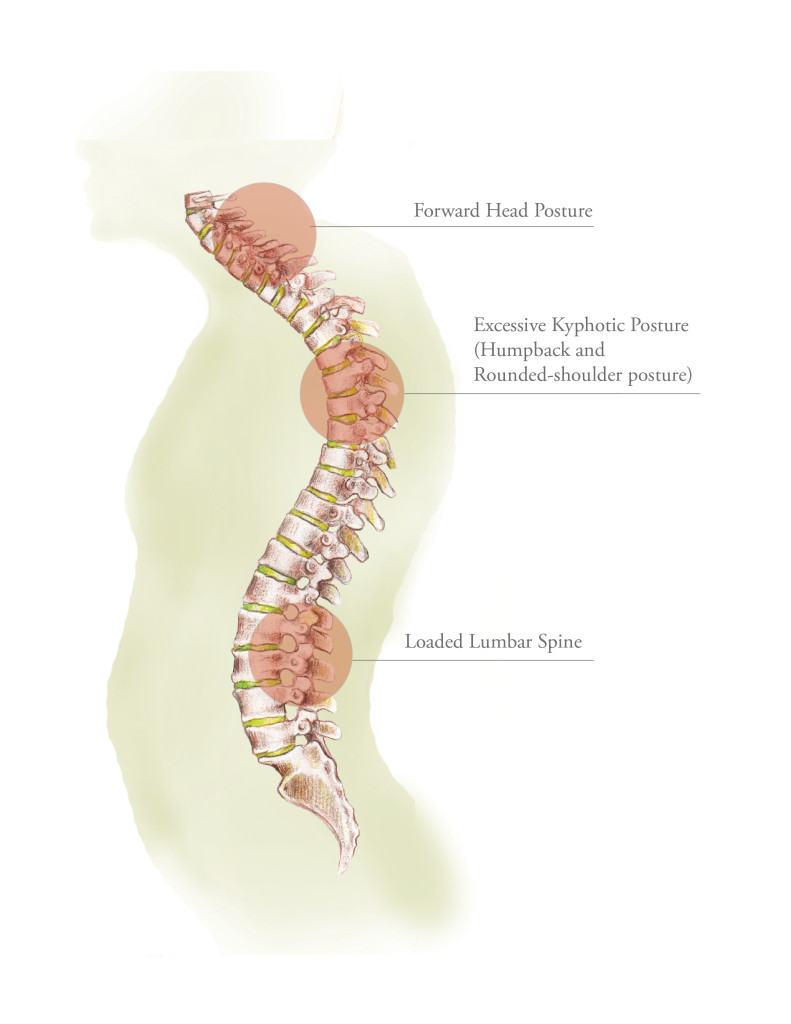 Neutral Spine Alignment 3